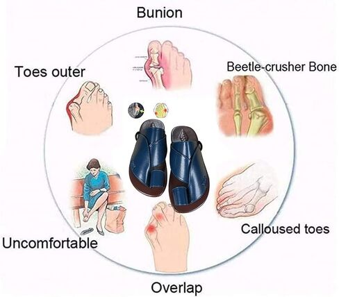 Yytcsjz Men's Bunion Corrector Sandals, Men's Flat Sandals Slippers,for Flat Feet and Plantar Fasciitis Orthopedic Toe Post Summer Beach Travel Shoes (Color : Black, Size : 9) in Saudi Arabia