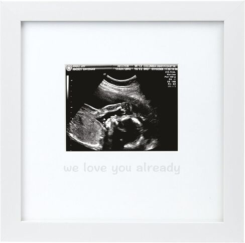 Tiny Ideas Love at First Sight Sonogram Keepsake Photo Frame, Ultrasound Photo Frame for Baby Girl or Baby Boy, 1 Count (Pack of 1) in Kuwait