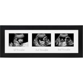 إطار صور Americanflat Sonogram - إطار صور بالموجات فوق الصوتية مقاس 7x7 بوصة لمسح الموجات فوق الصوتية للأطفال لصور الموجات فوق الصوتية مقاس 3x4 بوصة - حصيرة قابلة للتبديل وحامل حامل - خشب مركب مع غطاء زجاجي - أسود