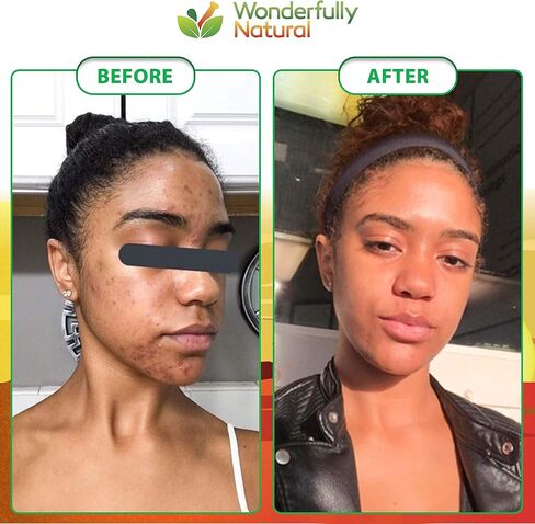 Organic African Black Soap - For Acne & Dark Spots | Natural Vegan and Cruelty Free – Satisfaction Guarantee 1lb bar | 90 day Supply in Saudi Arabia