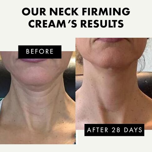 كريم شد الرقبة المضاد للشيخوخة من إكلات - علاج طبيعي لشد البشرة، مضاد للتجاعيد وتقليل الذقن المزدوجة - مع فيتامين C وE، مستخلص الشاي الأخضر - نباتي 100%، 1.7 أونصة in Kuwait