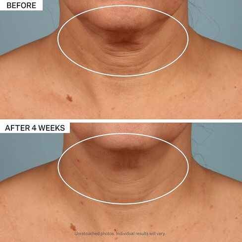 StriVectin Tighten & Lift Advanced Neck Cream PLUS with Alpha-3 Peptides™ for Neck & Décolleté, Smoothing Look of Wrinkles & Fine Lines, Improves Crepey Skin & Vertical Lines, for Soft Smooth Skin in Kuwait