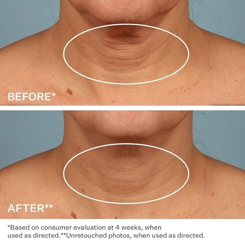 StriVectin Tighten & Lift Advanced Neck Cream PLUS with Alpha-3 Peptides™ for Neck & Décolleté, Smoothing Look of Wrinkles & Fine Lines, Improves Crepey Skin & Vertical Lines, for Soft Smooth Skin in Kuwait