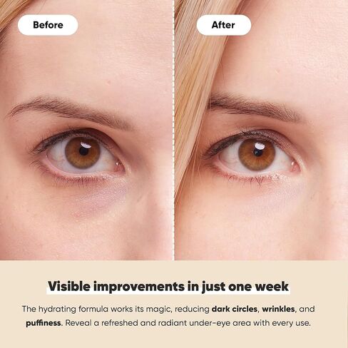 LE GUSHE Under Eye Patches - 24K Gold Under Eye Mask Anti-Aging Hyaluronic Acid Collagen Under Eye Pads Reducing Dark Circles & Wrinkles Treatment Gel Bags (20 pairs gold) in Saudi Arabia