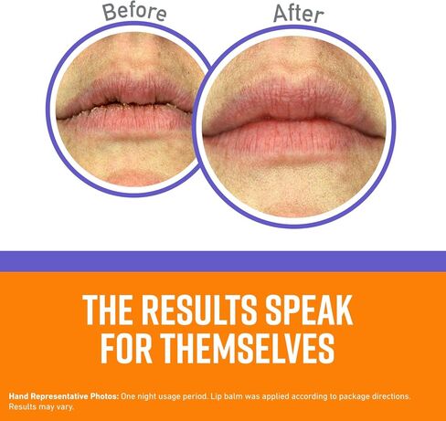 بلسم الشفاه العلاجي الليلي لإصلاح الشفاه من أوكيف، برطمان بحجم 25 أونصة (عبوة من قطعة واحدة) in Kuwait