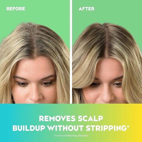 OGX قوة إضافية منتعشة لفروة الرأس + نعناع شجرة الشاي، شامبو منشط لفروة الرأس مع شجرة الشاي وزيت النعناع وبندق الساحرة، مواد خافضة للتوتر السطحي خالية من البارابين/الكبريتات، 13 أونصة سائلة in Kuwait