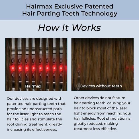 Hairmax Ultima 9 (FDA Cleared) Laser Hair Growth Comb, 100% Medical Grade Lasers (No LEDs), Laser Hair Growth Treatment for Men & Women, Thinning Hair Treatment for Women and Men, Denser & Fuller Hair, Spot or Full Scalp Coverage, Hair Growth Products to  in Saudi Arabia
