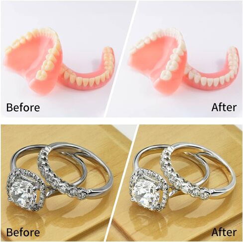 آلة تنظيف المثبات اللاسلكية من ايليرا سونيك لتنظيف الأسنان، منظف أطقم الأسنان، ماكينة تنظيف عملات معدنية ممتازة in Kuwait