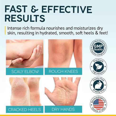 NUVADERMIS Urea Cream 40 Percent for Feet - 40% Urea Foot Repair Lotion - Maximum Strength For Dry Cracked Heels - 2% Salicylic Acid, Shea Butter, Tea Tree Oil, Vitamin E - 5.29 oz Jar in Saudi Arabia