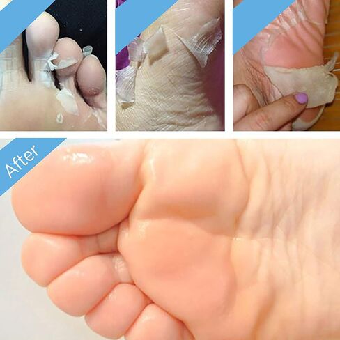 2 Pairs Foot Peel Mask Exfoliant for Soft Feet in 1-2 Weeks, Exfoliating Booties for Peeling Off Calluses & Dead Skin, For Men & Women Lavender by BEALUZ in Saudi Arabia