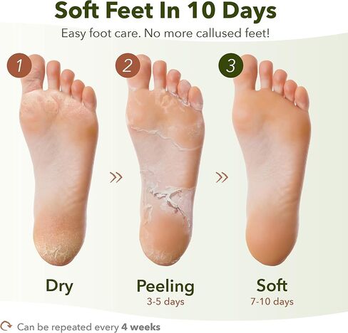 Purederm Foot Peeling Mask Set Exfoliating Foot Peel Spa Mask For Baby Soft Skin W/Sunflower Seed Oil & Lemon Extract - For Men & Women - Removes Dead Skin & Calluses In 2 Weeks, Pack of 3 in Kuwait