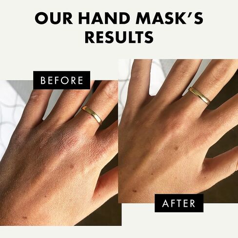 𝗪𝗜𝗡𝗡𝗘𝗥 𝟮𝟬𝟮𝟯* قناع لليدين بزبدة الشيا للأيدي الجافة وترطيب وتجديد الجلد الميت - نباتي وخالي من البارابين والعطور، 5 أزواج من أقنعة القفازات in Kuwait