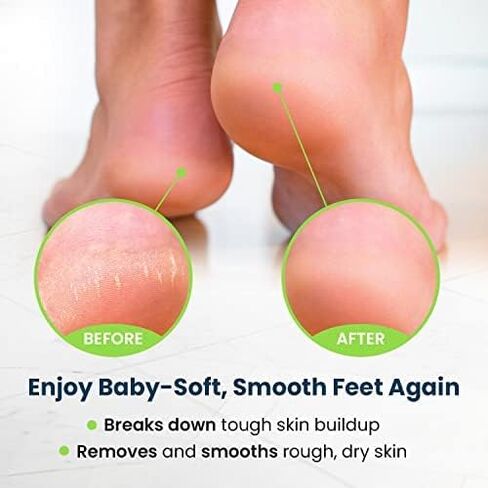 Toenail Fungus Treatment Kit Extra Strength - Foot Soak, Nail Repair Pen & Tea Tree Balm - Foot Care Kit, Great Solution for Smelly Feet, Athlete's Foot, Cracked & Fungal Discolored Nails - Made in USA in Saudi Arabia