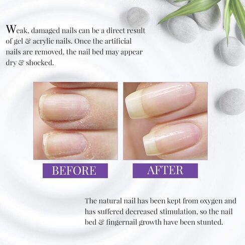Nail Tek Xtra 4, Nail Strengthener for Weak and Damaged Nails, 0.5 oz, 1-Pack in Saudi Arabia
