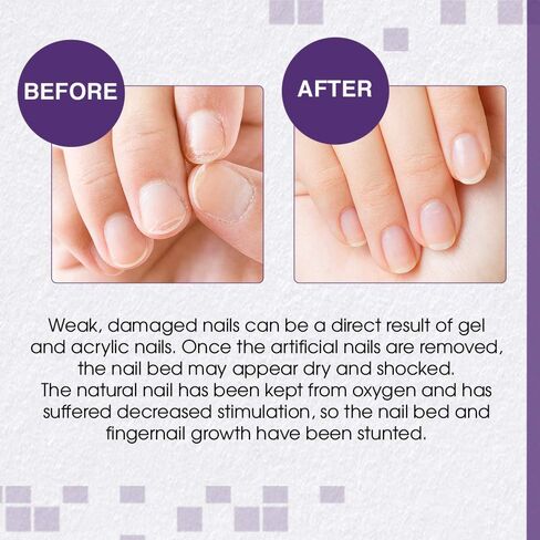 Nail Tek Xtra 4, Nail Strengthener for Weak and Damaged Nails, 0.5 oz, 1-Pack in Saudi Arabia