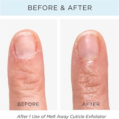 butter LONDON Melt Away Cuticle Exfoliator, cuticle remover for healthy looking nails, 0.4 Fl Oz (Pack of 1) in Saudi Arabia