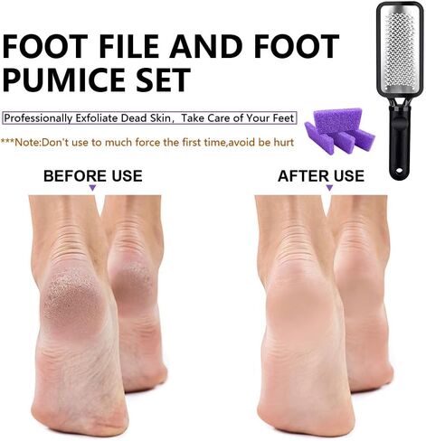 Foot Callus Remover Kit Foot File Callus Remover for Feet Pedicure Supplies Professional Metal Foot File and 20 PCS Pumice Stone for Feet Foot Scraper for Callus Removal Rough Dead Skin Removal. in Saudi Arabia