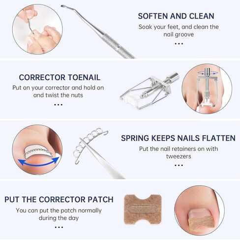 مجموعة علاج اظافر القدم النامية تحت الجلد - مصحح اظافر القدم الغارزة و12 دعامة لاظافر القدم و50 قطعة من رقع تصحيح اظافر القدم و10 شرائط لتصحيح الاظافر الغارزة in Kuwait