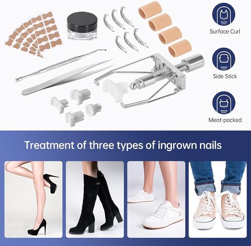 مجموعة علاج اظافر القدم النامية تحت الجلد - مصحح اظافر القدم الغارزة و12 دعامة لاظافر القدم و50 قطعة من رقع تصحيح اظافر القدم و10 شرائط لتصحيح الاظافر الغارزة in Kuwait