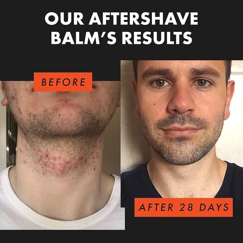 Eclat Skincare 𝗪𝗜𝗡𝗡𝗘𝗥 𝟮𝟬𝟮𝟯* بعد الحلاقة للرجال، بلسم ما بعد الحلاقة خفيف وغير دهني يقلل من حرق ماكينة الحلاقة والنتوء والاحمرار، مرطب بعد الحلاقة للرجال، غسول ما بعد الحلاقة عضوي 100% in Kuwait
