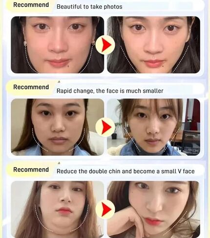 قناع النوم لنحت الوجه من Huien Beauty، 2023 أقنعة الوجه الجديدة على شكل حرف V، أقنعة الوجه على شكل حرف V قابلة لإعادة الاستخدام، قناع على شكل حرف V للوجه وخط الذقن، مشكل الوجه (ب) in Kuwait