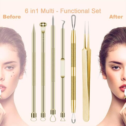 5pcs Blackhead Remover Tweezers Pimple Popper Tool Kit, Precision Acne Needle Comedone Blackhead Tweezers Extractor Removal Whitehead Popping Zit for Nose Face Skin Blemish Extractor Tool - Glossy in Saudi Arabia