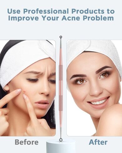 Blackhead Remover Tool, Pimple Popper Tool Kit, Blackhead Extractor Tool for Face, Extractor Tool for Comedone Zit Acne Whitehead Blemish, Stainless Steel Extraction Tools in Kuwait