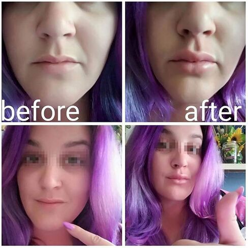 أداة تكبير الشفاه، سيليكون محسن الشفاه بالكامل، جهاز ضخ الشفاه على شكل سمكة، كوب شفط الشفاه، جهاز تعزيز الشفاه، أداة تجميل in Kuwait