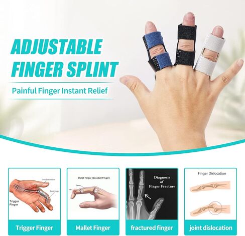 Finger Splints (3PCS), Finger Support Braces, Adjustable Finger Protectors Sleeves for Trigger Finger, Mallet Finger, Broken Finger, Arthritis, Knuckle Immobilization, Straightening. Best Fit for Index Middle Ring Finger in Kuwait