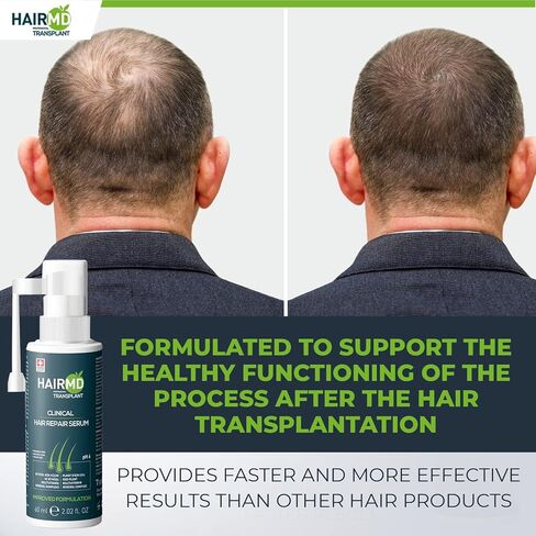 HairMD Transplant Hair Repair Set with Shampoo and Serum - Potent Hair Loss Treatment Formula with Biotin, Keratin, Collagen, Provitamin B5 - Soothing Hair Care Products for Hair Transplant Recovery in Saudi Arabia