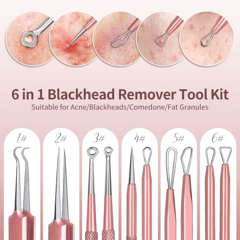 أداة إزالة الرؤوس السوداء، 6 قطع من أداة إزالة البثور من TsMADDTs، أداة إزالة حب الشباب لوجه الأنف مع حقيبة جلدية محمولة (ذهبي وردي) in Kuwait
