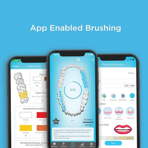Blu Smart Bluetooth Enabled Kids Toothbrush with Live Tracking App to Teach Children Healthy Brushing Habits, Share Results with Your Dentist, Wireless Rechargeable Electric (Pink) in Saudi Arabia
