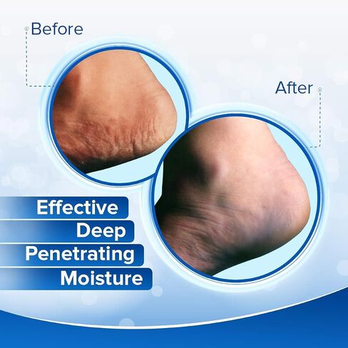 Dermal Therapy - Heel Care Cream, Foot Cream for Dry Cracked Heels, Intense Foot Moisturizer with Urea and AHA, Foot Lotion and Feet Exfoliator with Non-Greasy Formula, 3 o.z. in Saudi Arabia