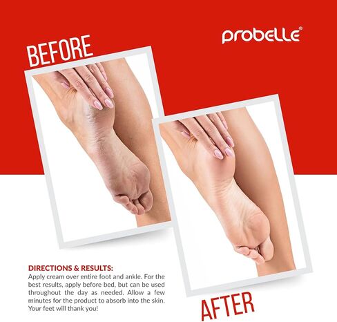 Probelle Advanced Total Foot Cream: Soothes, Hydrates, Rejuvenates Skin For Rough, Dry, Cracked & Sore Feet, 3 Ounces in Kuwait