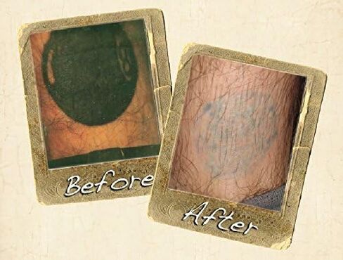 Wrecking Balm Tattoo Fade System For Helping Remove Tattoos From Body, At Home Tattoo & Ink Removal Kit For Fading Unwanted Tattoo's in Saudi Arabia