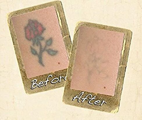 Wrecking Balm Tattoo Fade System For Helping Remove Tattoos From Body, At Home Tattoo & Ink Removal Kit For Fading Unwanted Tattoo's in Saudi Arabia
