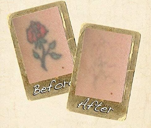 Wrecking Balm Tattoo Fade System For Helping Remove Tattoos From Body, At Home Tattoo & Ink Removal Kit For Fading Unwanted Tattoo's in Saudi Arabia