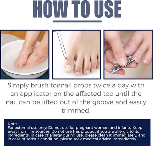 3 قطع من زيت الداحس لازالة اظافر القدمين، زيت الماني للعناية باظافر القدمين، سائل تجديد الاظافر التالف وتغير اللون، زيت علاج اظافر القدم لاصلاح وتحسين صحة اظافر القدم in Kuwait