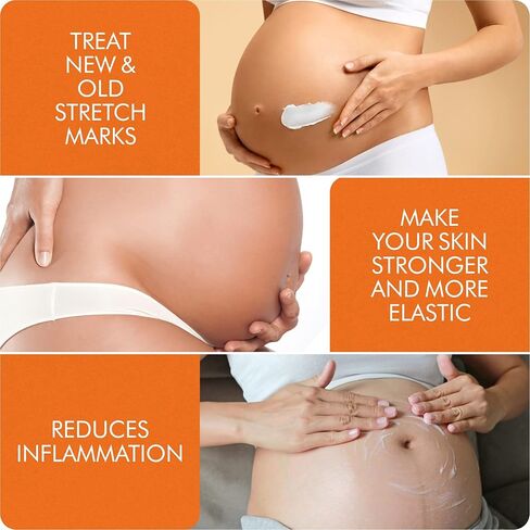 V.SACHAR MD Accredited Stretch Mark Cream for Pregnancy | This Skin Care Cream Helps in Prevention of New and Removal of Old Stretch Marks in During Maternity | 4 Fl Oz in Saudi Arabia