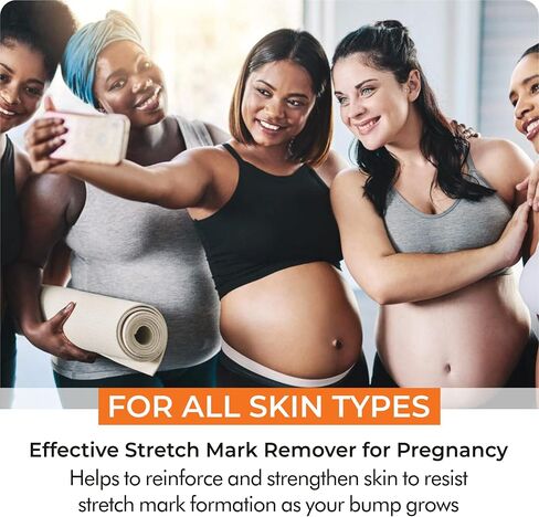 V.SACHAR MD Accredited Stretch Mark Cream for Pregnancy | This Skin Care Cream Helps in Prevention of New and Removal of Old Stretch Marks in During Maternity | 4 Fl Oz in Saudi Arabia