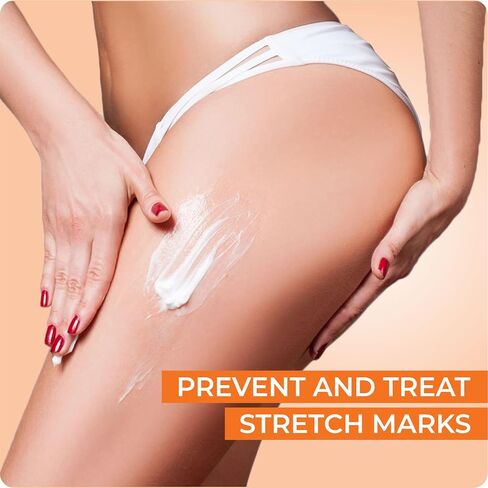 V.SACHAR MD Accredited Stretch Mark Cream for Pregnancy | This Skin Care Cream Helps in Prevention of New and Removal of Old Stretch Marks in During Maternity | 4 Fl Oz in Saudi Arabia