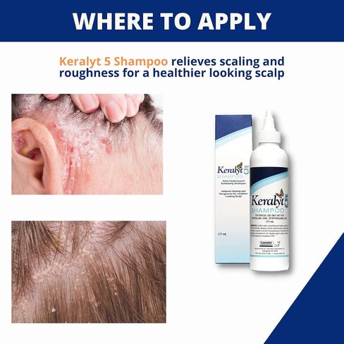 3% Salicylic Acid Gel - Exfoliating Moisturizing Skin Gel - Promotes Relief from Itchy, Redness, Dryness, Roughness, and Flakey Skin from Psoriasis, Eczema, Acne, Dermatitis in Saudi Arabia