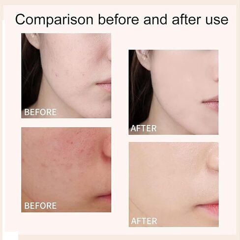 كريم XIGUA لضبط لون البشرة بعامل حماية من الشمس SPF 50، كريم CC لمستحضرات التجميل، تصحيح اللون ذاتي الضبط للبشرة الناضجة، كريم أساس وواقي من الشمس للوجه الكل في واحد، لون طبيعي 1.01 أونصة (قطعتان) in Saudi Arabia