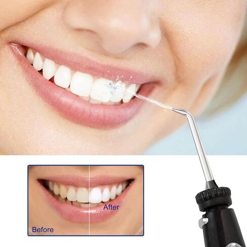 Oral Hygiene Accessories Compatible with Waterpik WP-100, WP-900 Replacement Kit for Ultra Water Flosser, Pack of 1 Handle/Hose（Black） in Saudi Arabia