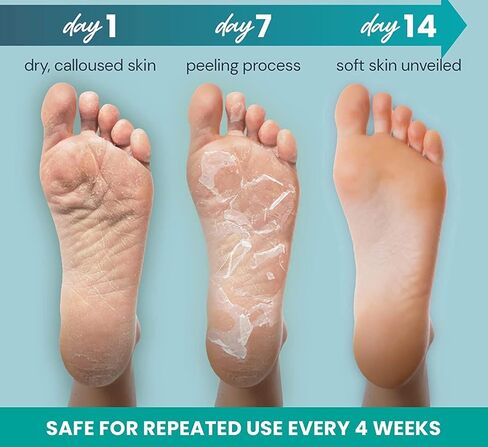 5 أزواج من أقنعة تقشير القدم | تقشر الجلد الميت ويزيل الكالو لأقدام الطفل الناعمة | جودة ممتازة | من لامور نعم! in Kuwait