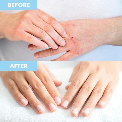 Bodipure Premium Hand Mask Keratin Gloves | Moisturizing Gloves for Dry Hands & Nail-Strengthening & Cuticle Softening | Spa Experience at Home | Chemical Free & For All Skin Types | 1 Pair in Kuwait