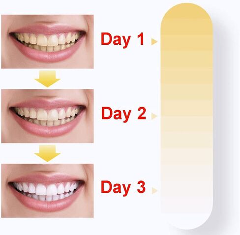 فينماكس مصباح LED لتبييض الاسنان بـ 3 اوضاع اضاءة لتسريع الاسنان يثبت على كرسي الاسنان - ترقية جديدة لعام 2022 in Kuwait