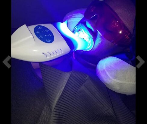 فينماكس مصباح LED لتبييض الاسنان بـ 3 اوضاع اضاءة لتسريع الاسنان يثبت على كرسي الاسنان - ترقية جديدة لعام 2022 in Kuwait