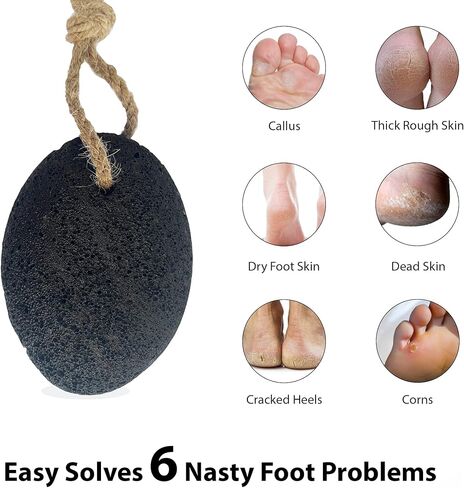 Foot Pumice Stone by VNI Stone - Natural Earth Lava Pumice Stone for Feet callus removal- Callus Warts Corn Removal - Pedicure Exfoliator for Dry Dead Skin, Heels, Palm - Healthy Foot Care Scrubber in Saudi Arabia
