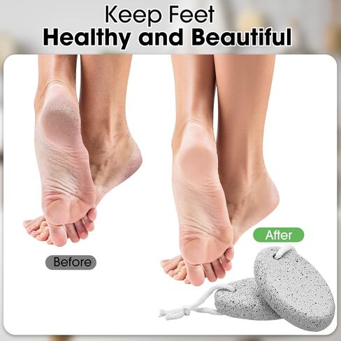 لونسوير 50 قطعة من حجر الخفاف للقدمين، ادوات باديكير لافا طبيعية لتقشير القدم وازالة مسامير القدم واليدين، حجر الخفاف لازالة الجلد الميت والكعوب والمرفقين واليدين in Kuwait